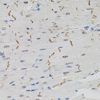 BCL2 / Bcl-2 Antibody