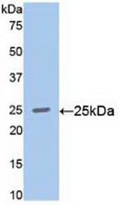 RALA / RAL Antibody (aa1-206)