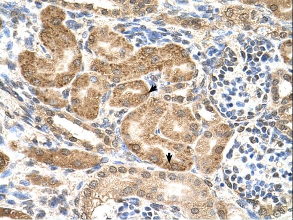 GMPPB Antibody (C-Terminus)