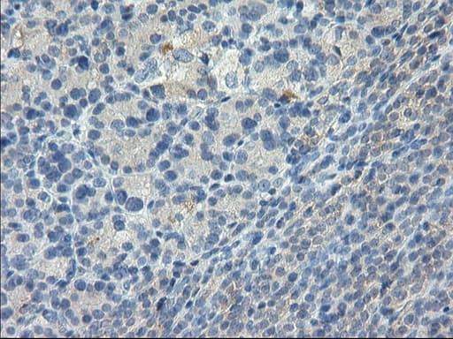 GPR49 / LGR5 Antibody (aa250-550, clone OTI2A2)