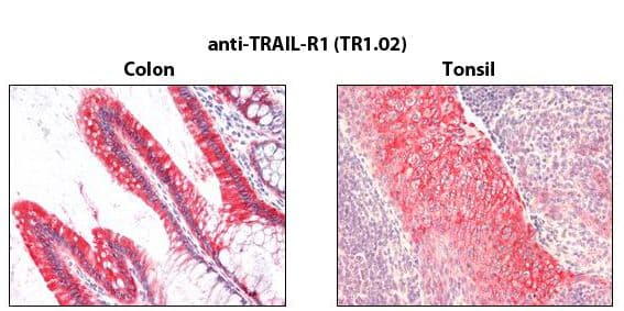 TNFRSF10A / DR4 Antibody (clone TR1.02)