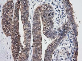 DSTN / Destrin Antibody (clone OTI2F7)