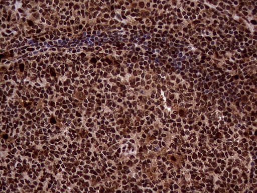 TALDO1 / Transaldolase 1 Antibody (clone OTI2E4)