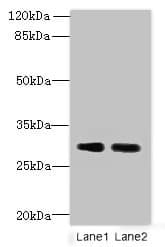Polyclonal Rabbit anti-Human DNALI1 Antibody (IHC, WB)
