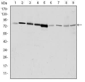 ADRBK1 / GRK2 Antibody (clone 3F8)