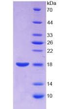 Human ANXA2 / Annexin A2 Protein (Recombinant His)