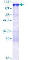 Human EPS8L2 Protein (Recombinant GST)