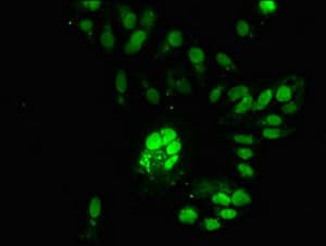 Polyclonal Rabbit anti-Human RNASEH2C / AGS3 Antibody (IHC, IF, WB)