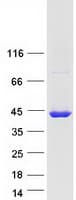 Human ACMSD Protein (Recombinant Myc-DDK (Flag))