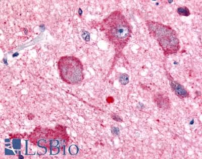 PathPlus™ Polyclonal Rabbit anti-Human PRKCZ / PKC-Zeta Antibody (N-Terminus, IHC)