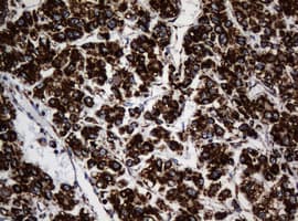 Monoclonal Mouse anti-Human NDUFB10 Antibody (clone OTI2G1, IHC, WB)