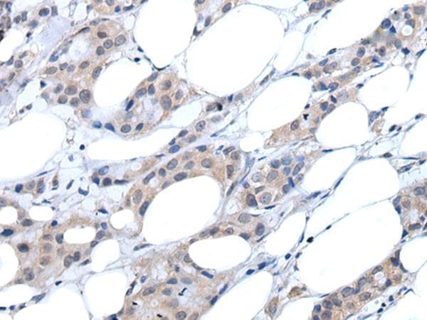 ARP5 / ANGPTL6 Antibody