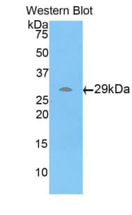 STC2 / Stanniocalcin 2 Antibody (aa53-294)