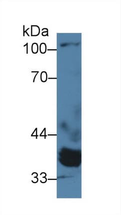 PPM1A / PP2CA Antibody (aa2-382)