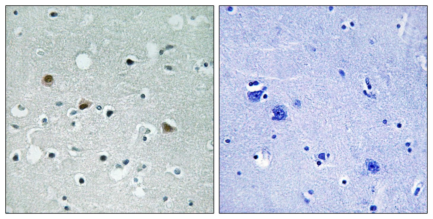 LATS1 + LATS2 Antibody (phospho-Thr1079/1041)