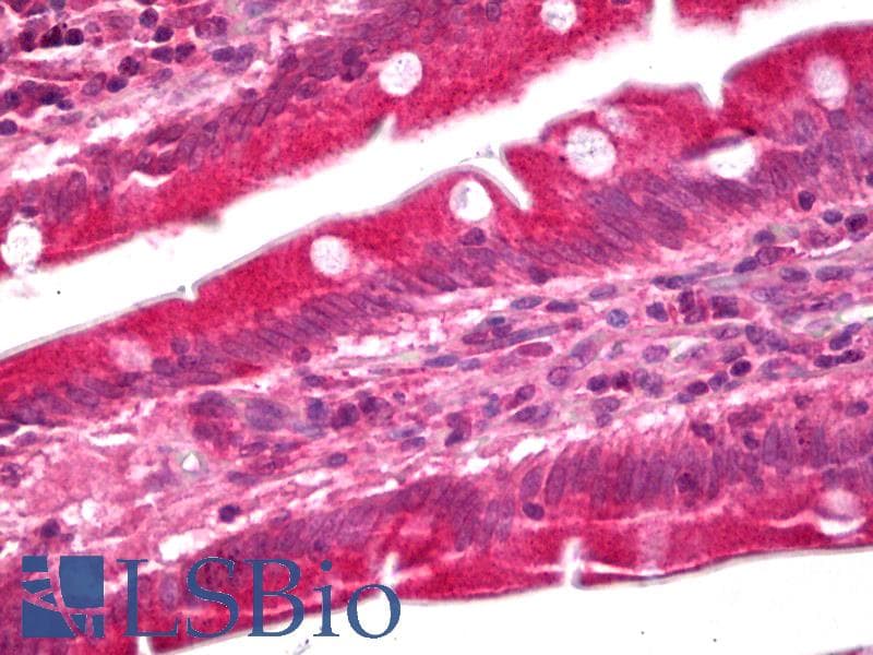 IHC-plus™ Polyclonal Rabbit anti-Human GUCY1A1 / GUCY1A3 Antibody (IHC, WB)