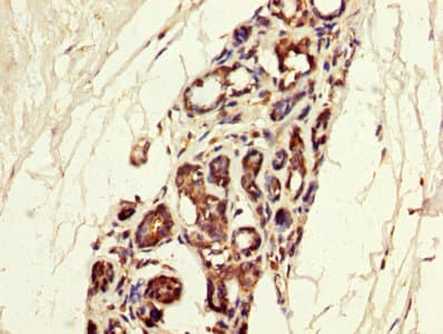 Polyclonal Rabbit anti-Human MGP / Matrix Gla-Protein Antibody (aa20-96)