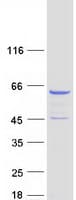 Human CORO2A Protein (Recombinant Myc-DDK (Flag))