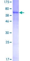 Human SERPINA7 / TBG Protein (Recombinant GST)