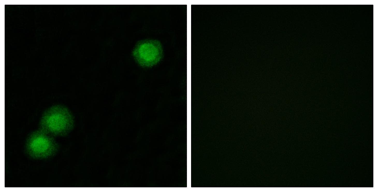 PKIB Antibody