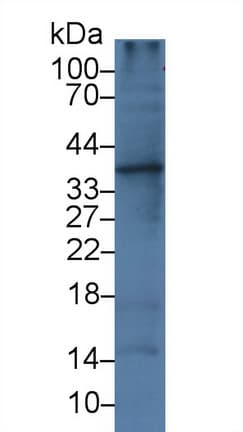 IL1A / IL-1 Alpha Antibody
