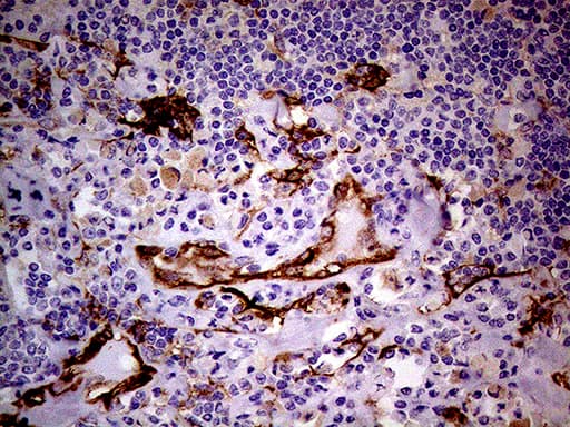 Monoclonal Mouse anti-Human TGM2 / Transglutaminase 2 Antibody (clone OTI1A3, IHC, WB)