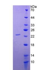 Human COL17A1 / Collagen XVII Protein (Recombinant His)