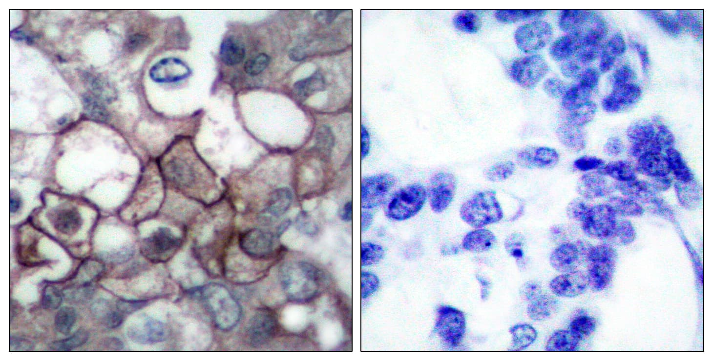 EGFR Antibody (phospho-Tyr1197)