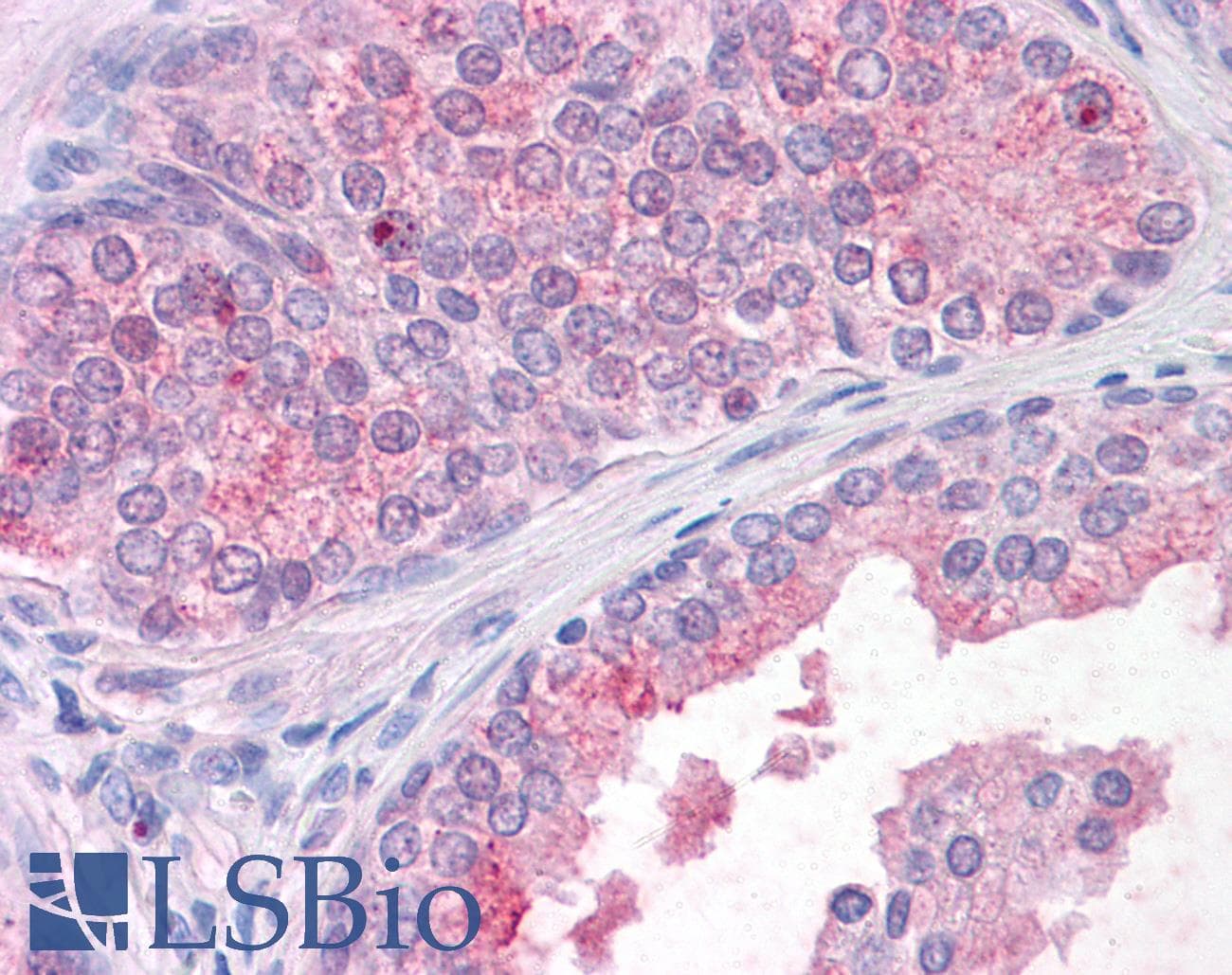 IHC-plus™ TM9SF1 Antibody (Internal)