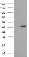 Monoclonal Mouse anti-Human ACAA2 Antibody (clone OTI2F6, IHC, IF, WB)