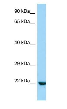 RRP22 / RASL10A Antibody (N-Terminus)