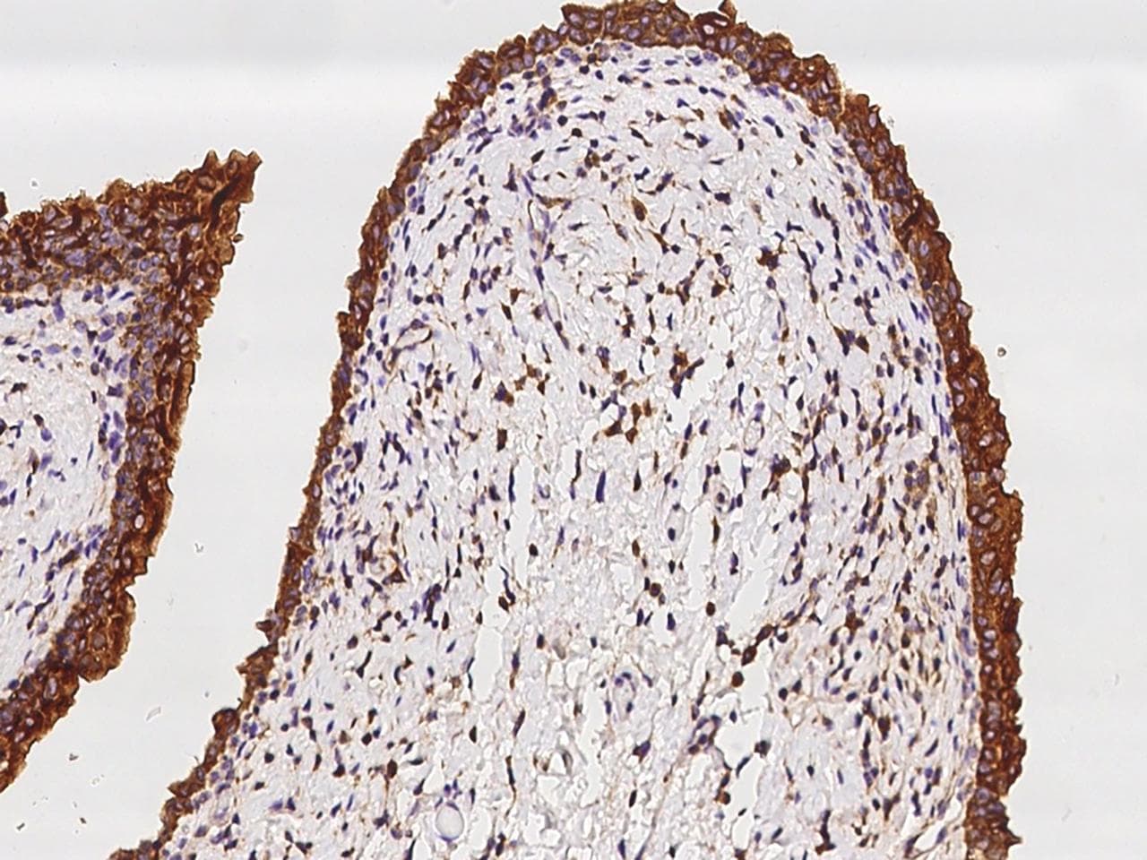 SH3GLB2 / Endophilin-B2 Antibody