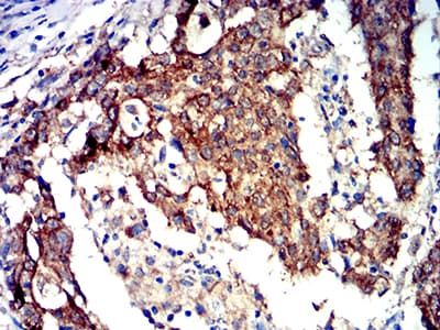 Monoclonal Mouse anti-Human PRKAA2 / AMPK Alpha 2 Antibody (clone 8E11H5, IHC, WB)