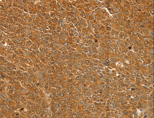 ST18 Antibody