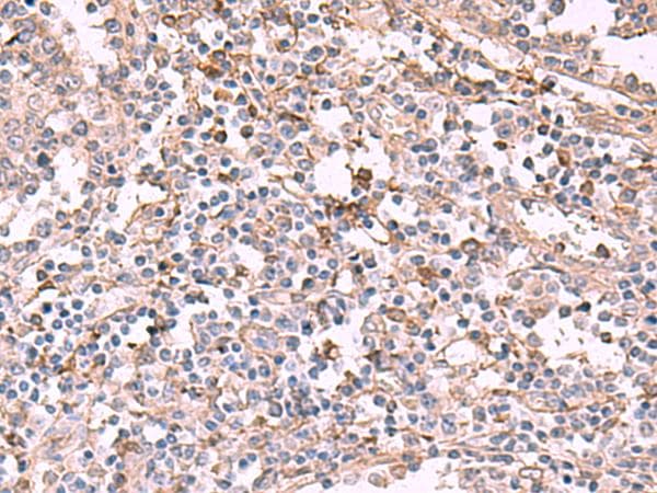 ADH2 / ADH1B Antibody