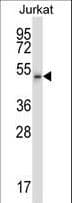 CDK15 / ALS2CR7 Antibody (aa96-124)