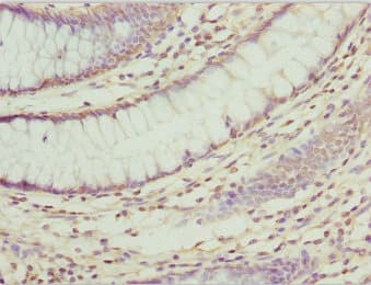 Polyclonal Rabbit anti-Human ZNF169 Antibody (IHC, WB)