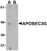 Polyclonal Rabbit anti-Human APOBEC3G / CEM15 Antibody (IHC, WB)