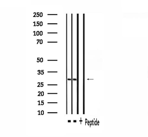 Polyclonal Rabbit anti-Human SGK494 Antibody (WB)