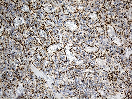 MCAD / ACADM Antibody (clone OTI10A5)
