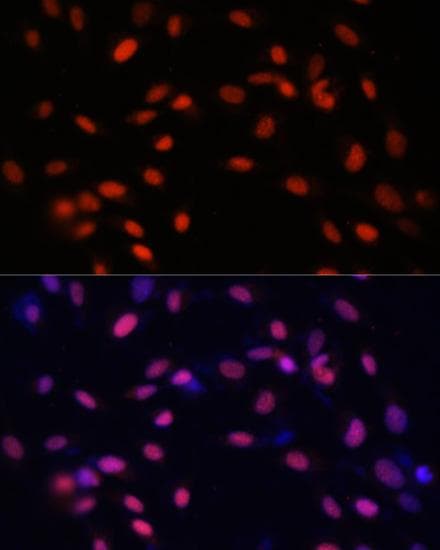ZNF177 / PIGX Antibody
