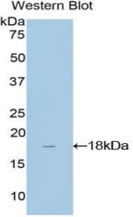 TAF13 Antibody (aa1-124)