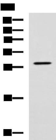 Polyclonal Rabbit anti-Human LRAT Antibody (IHC, WB)