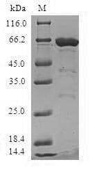 Human MRPS6 / MRP S6 Protein (Recombinant GST, N-terminus)