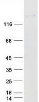 Human GLI / GLI1 Protein (Recombinant Myc-DDK (Flag))
