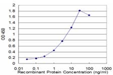Monoclonal Mouse anti-Human LAMP2 / CD107b Antibody (clone 2G10, WB)