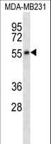 Polyclonal Rabbit anti-Human HTR7 / 5HT7 Receptor Antibody (aa405-433, WB)
