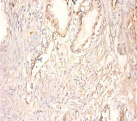 CKMT1 Antibody