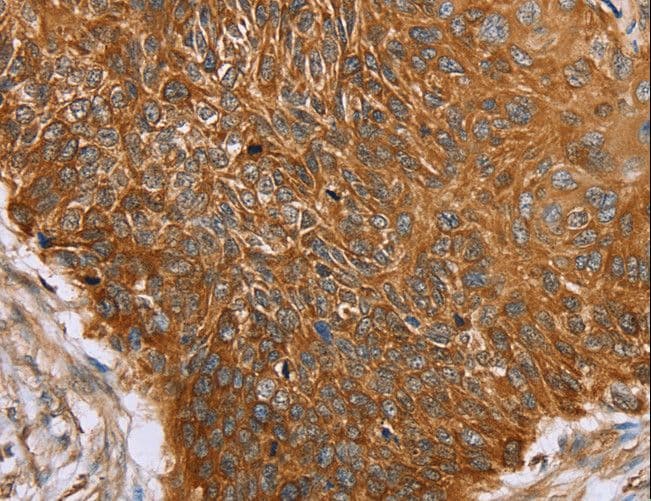 Polyclonal Rabbit anti-Human PAICS / ADE2 Antibody (IHC, WB)