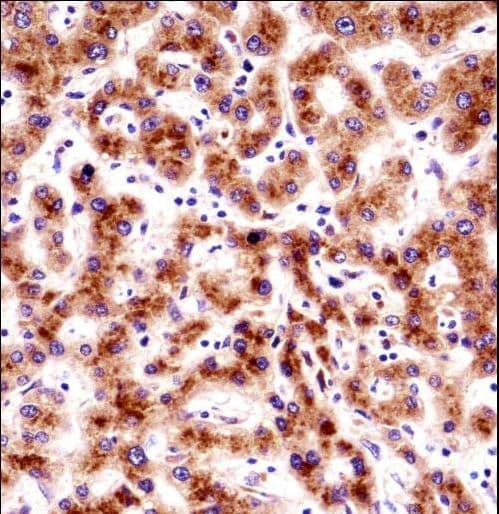 Polyclonal Rabbit anti-Human SEC61B Antibody (aa42-70, IHC, WB)